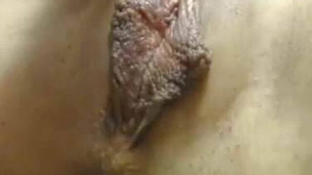 I have a beautiful pudendal cleft!